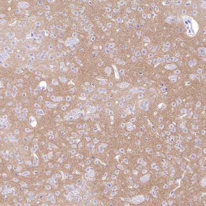 KCND2 Recombinant Rabbit mAb (S-3102-32)