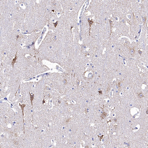 Parkin Rabbit Polyclonal Antibody
