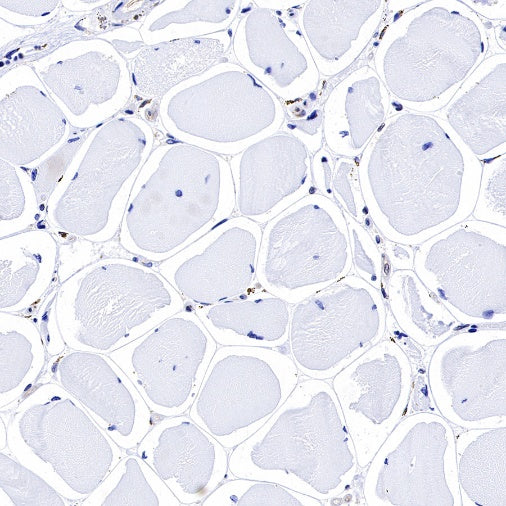 Bad Recombinant Rabbit mAb (S-976-26)