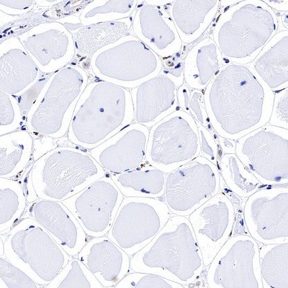 Bad Recombinant Rabbit mAb (S-976-26)