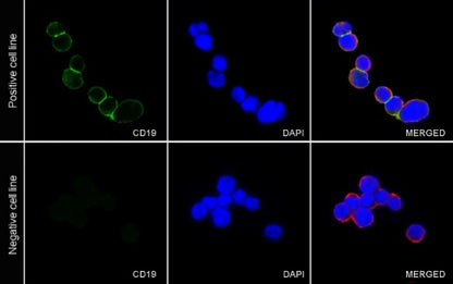 CD19 Mouse mAb (S-1039-46)