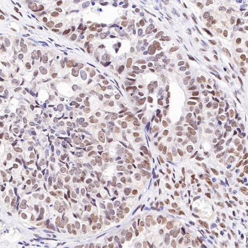 S-RMab® ATRX Recombinant Rabbit mAb (SDT-458-37)