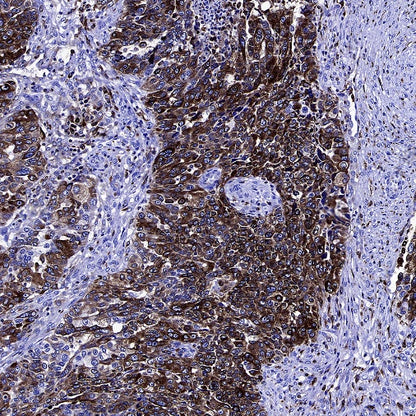 CD74 Recombinant Rabbit mAb (S-4524-58)