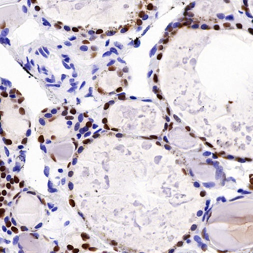 PAX8 Recombinant Rabbit mAb (SDT-R509)