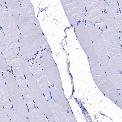 Somatostatin Receptor 2 Recombinant Rabbit mAb (SDT-2507-1)