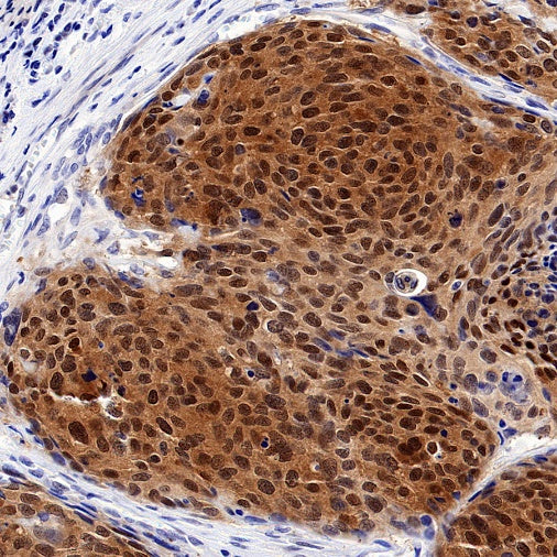 HSP70 Recombinant Rabbit mAb (S-992-39)