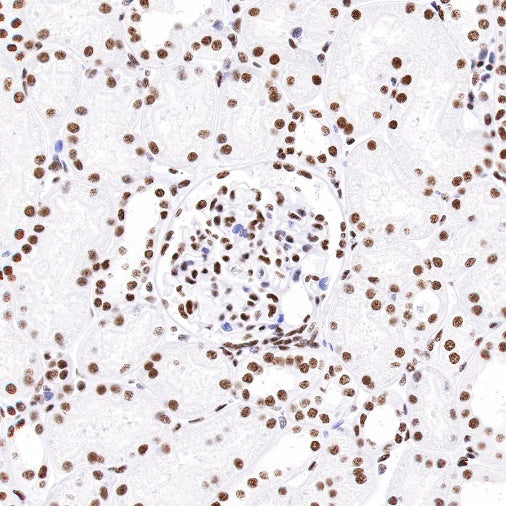 nmt55/p54nrb Recombinant Rabbit mAb (S-1745-48)