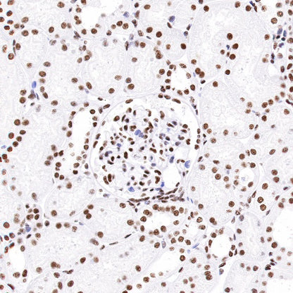 nmt55/p54nrb Recombinant Rabbit mAb (S-1745-48)