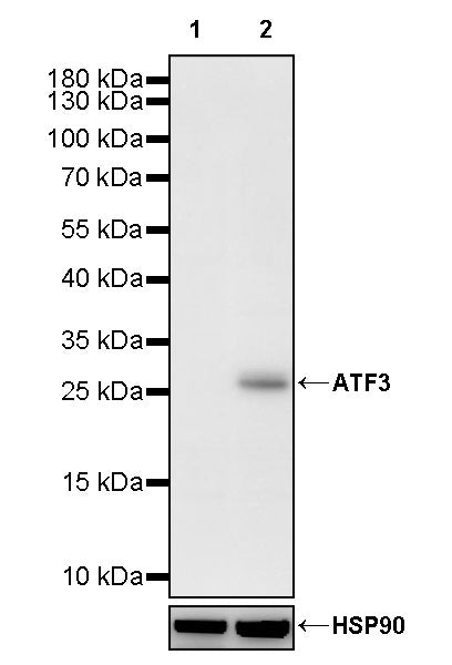 ATF3 Recombinant Rabbit mAb (S-3904)