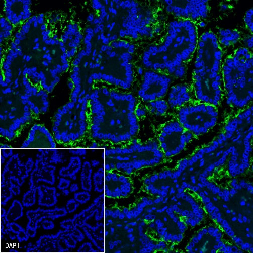 NaPi2b/SLC34A2 Recombinant Rabbit mAb (SDT-R229)