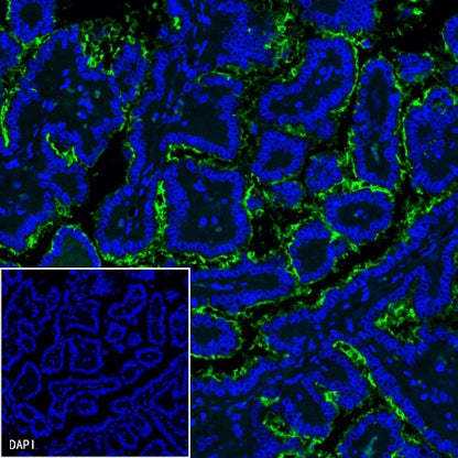 NaPi2b/SLC34A2 Recombinant Rabbit mAb (SDT-R229)
