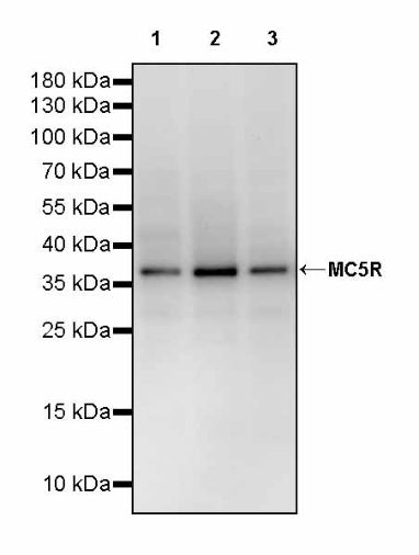 MC5R Recombinant Rabbit mAb (S-3142-41)