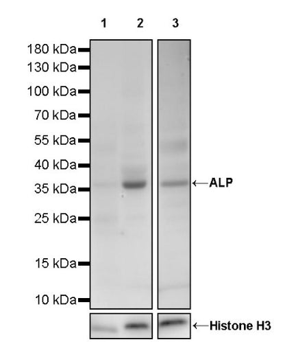 ALP Recombinant Rabbit mAb (S-2786-41)