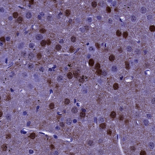 DARPP32 Recombinant Rabbit mAb (S-1637-62)