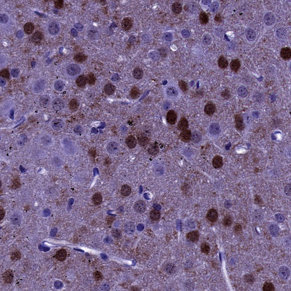 DARPP32 Recombinant Rabbit mAb (S-1637-62)