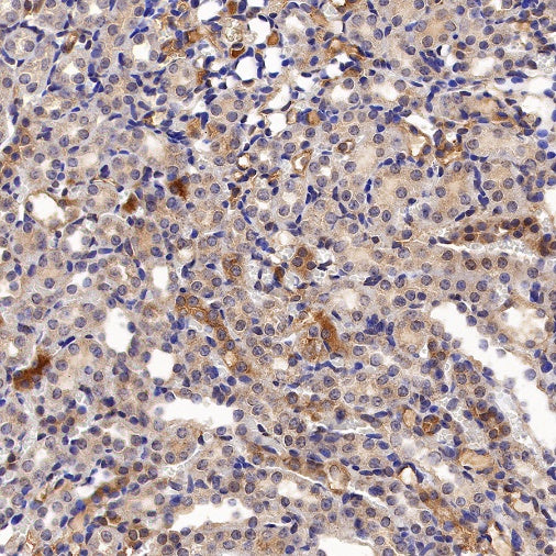 Glutathione Peroxidase 1 Recombinant Rabbit mAb (S-1714-17)
