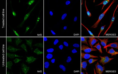 Nrf2 Recombinant Rabbit mAb (S-3183)