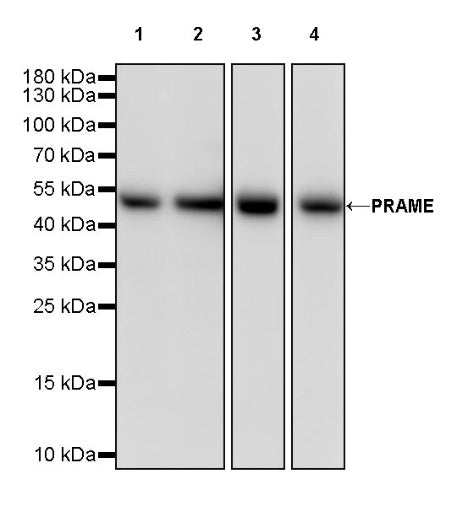 PRAME Recombinant Rabbit mAb (S-1876-173)