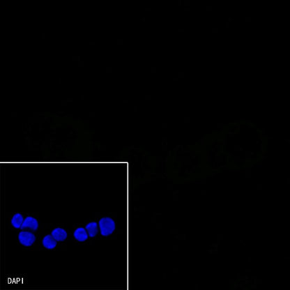 HLA-DPB1 Recombinant Rabbit mAb (S-R263)