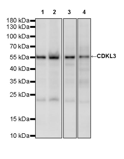 CDKL3 Recombinant Rabbit mAb (S-4356-11)