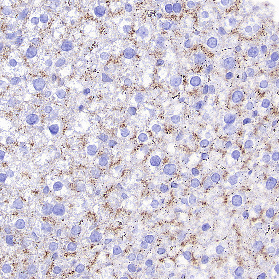 Niemann Pick C1 Recombinant Rabbit mAb (S-5243)