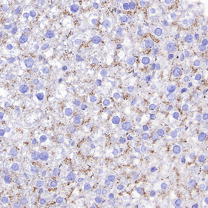 Niemann Pick C1 Recombinant Rabbit mAb (S-5243)