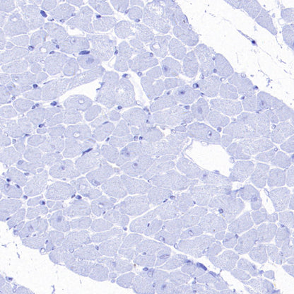 YTHDC2 Recombinant Rabbit mAb (S-3338-41)