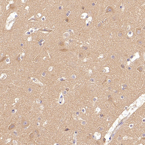 Rab5 Recombinant Rabbit mAb (S-1506-128)