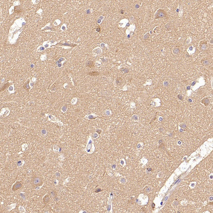 Rab5 Recombinant Rabbit mAb (S-1506-128)