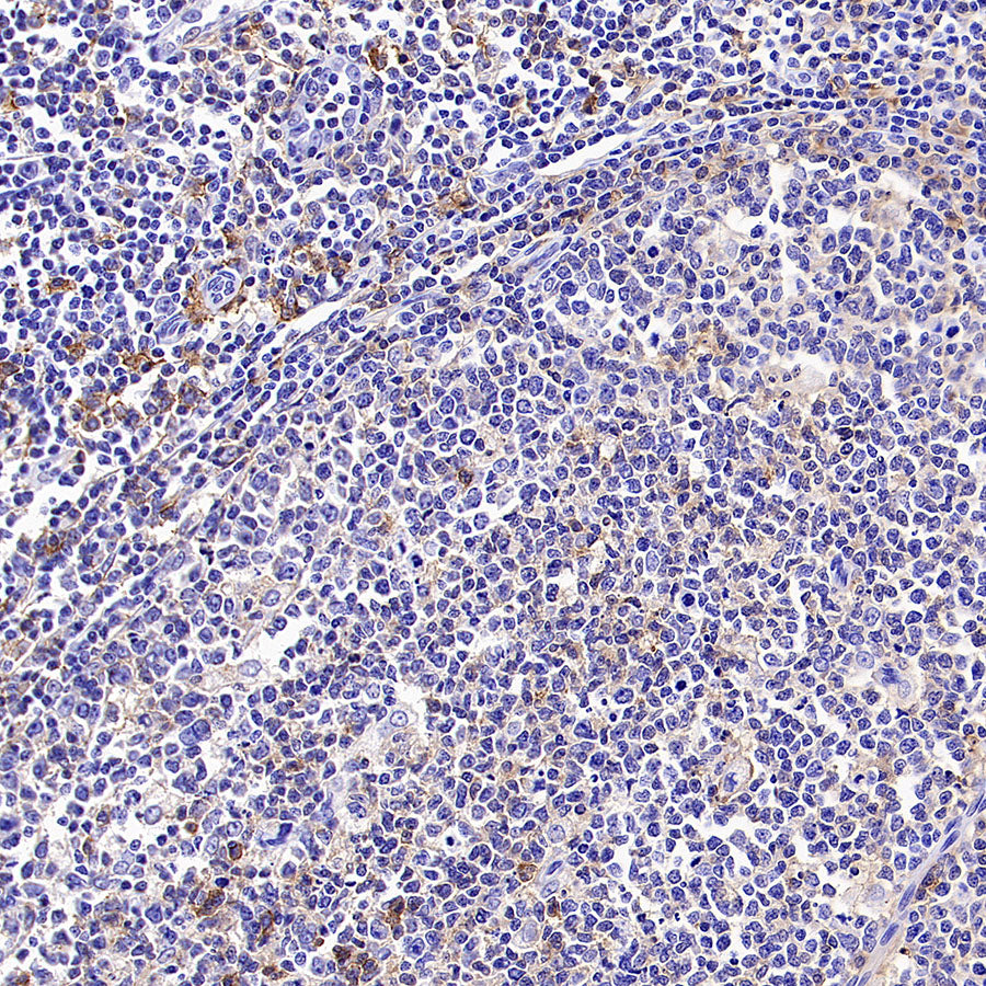 LILRB1 Recombinant Rabbit mAb (S-5001)