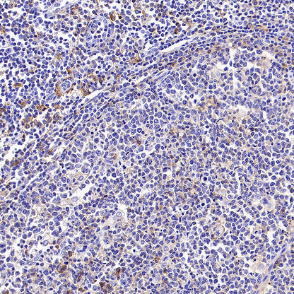 LILRB1 Recombinant Rabbit mAb (S-5001)