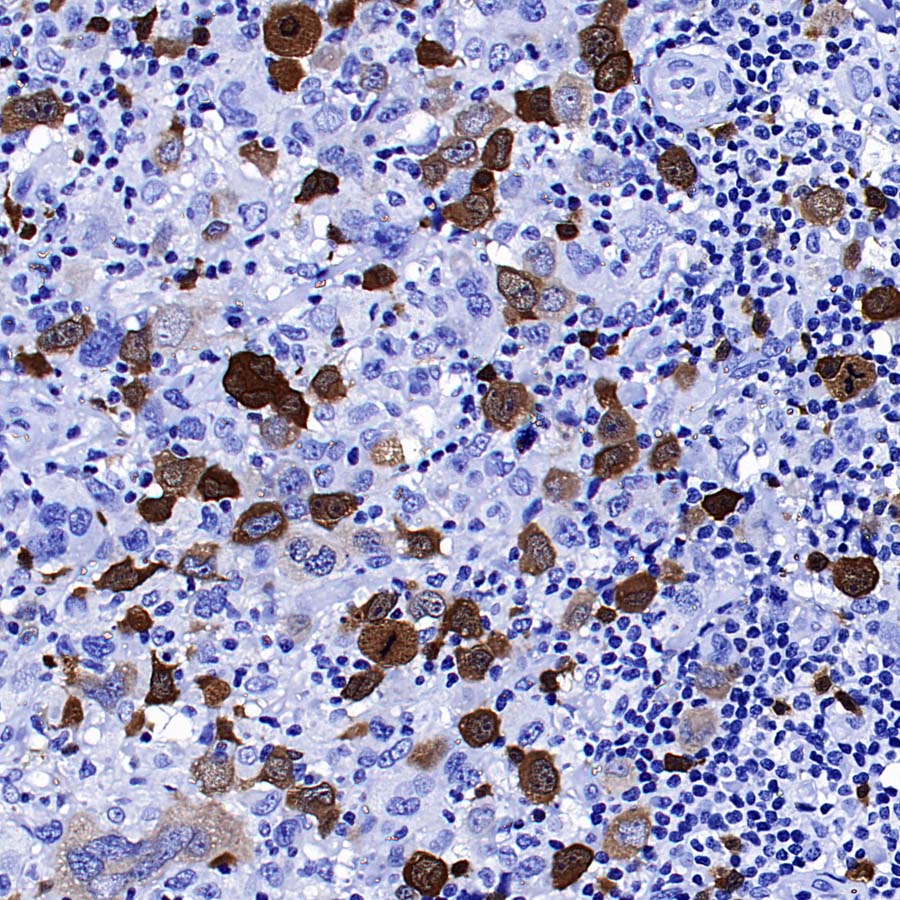 Thymidine Kinase 1 Recombinant Rabbit mAb (S-4127-43)