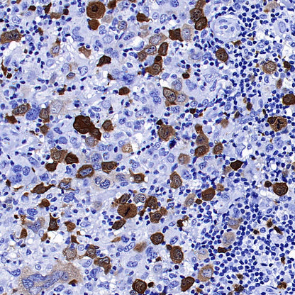 Thymidine Kinase 1 Recombinant Rabbit mAb (S-4127-43)