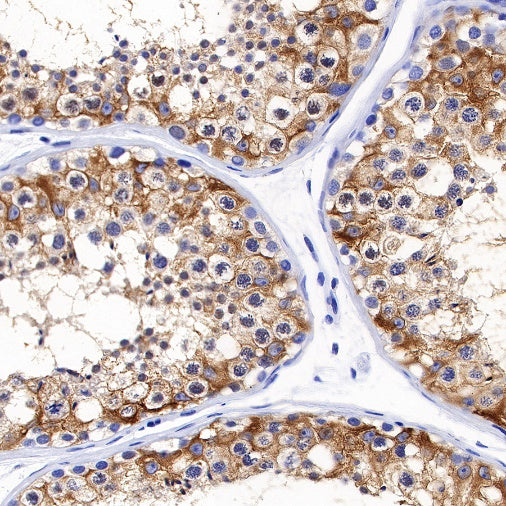 Inhibin alpha Recombinant Rabbit mAb (SDT-R307)