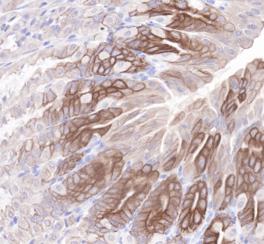 Cytokeratin 19 Recombinant Rabbit  mAb,PBS Only (SDT-107-19)