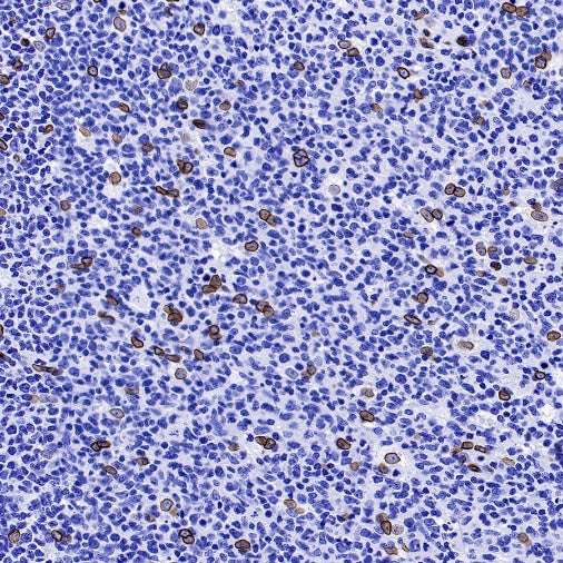 Lamin A Recombinant Rabbit mAb (S-1503-44)