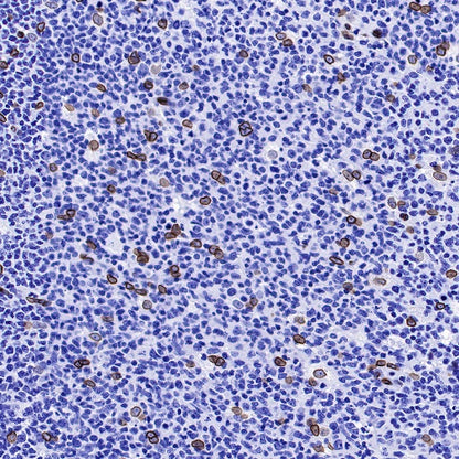 Lamin A Recombinant Rabbit mAb (S-1503-44)