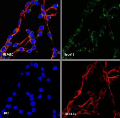 Sec61B Recombinant Rabbit mAb (S-4499-3)