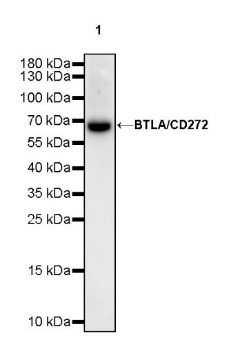 BTLA/CD272 Recombinant Rabbit mAb (S-742-13-2)
