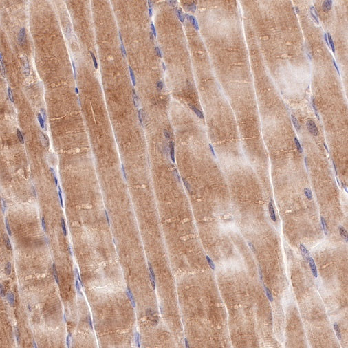NDRG2 Recombinant Rabbit mAb (S-618-76)