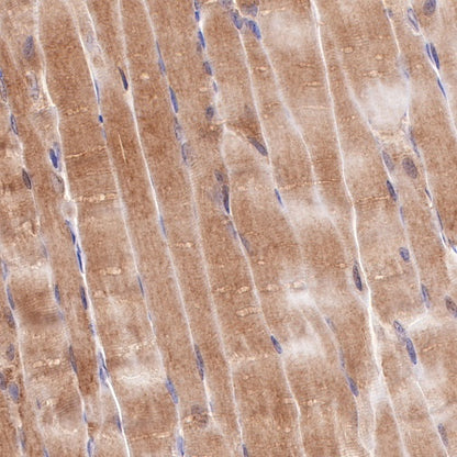 NDRG2 Recombinant Rabbit mAb (S-618-76)