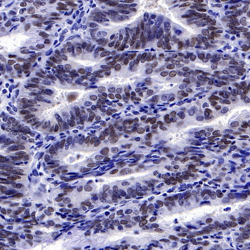 FoxO3a Recombinant Rabbit mAb (S-465-41)
