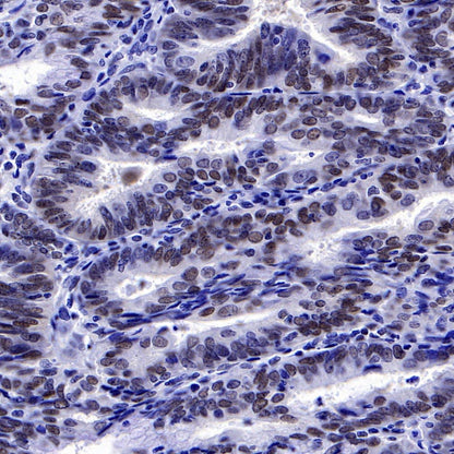 FoxO3a Recombinant Rabbit mAb (S-465-41)