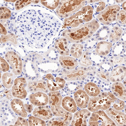 IDH1 Recombinant Rabbit mAb (S-792-16)