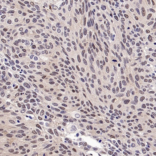 PSME4 Recombinant Rabbit mAb (S-3132-44)
