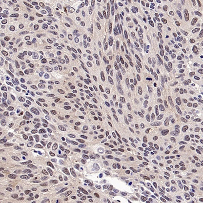 PSME4 Recombinant Rabbit mAb (S-3132-44)