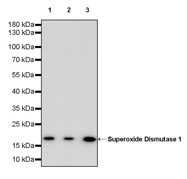 Superoxide Dismutase 1 Recombinant Rabbit mAb (S-1537-39)