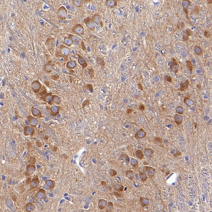 KIF3A Recombinant Rabbit mAb (S-1083-9)