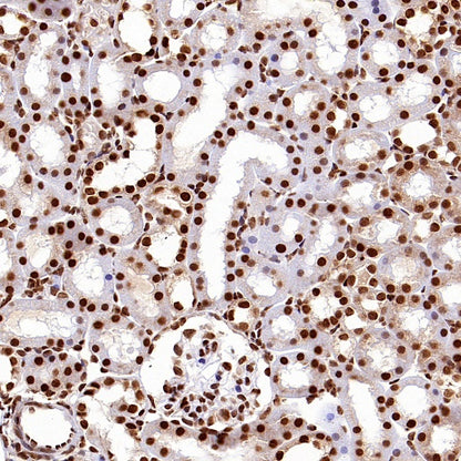 HuR/ELAVL1 Recombinant Rabbit mAb (S-2357-20)