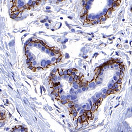 Integrin beta1/CD29 Recombinant Rabbit mAb (SDT-255-52)